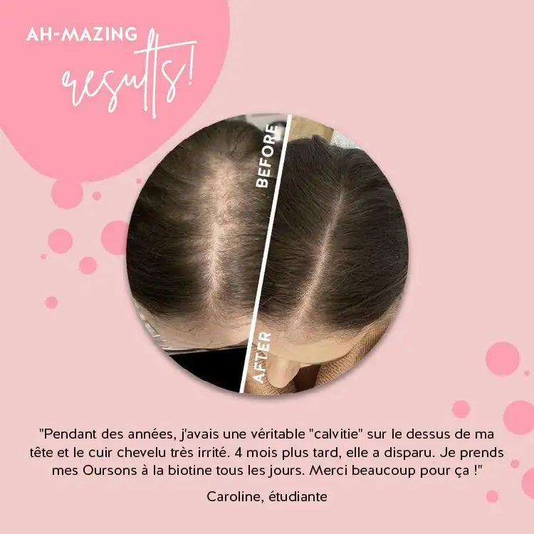 Le mécanisme d'action de la biotine dans Ah-mazing Hair Vitamins de Bears With Benefits
